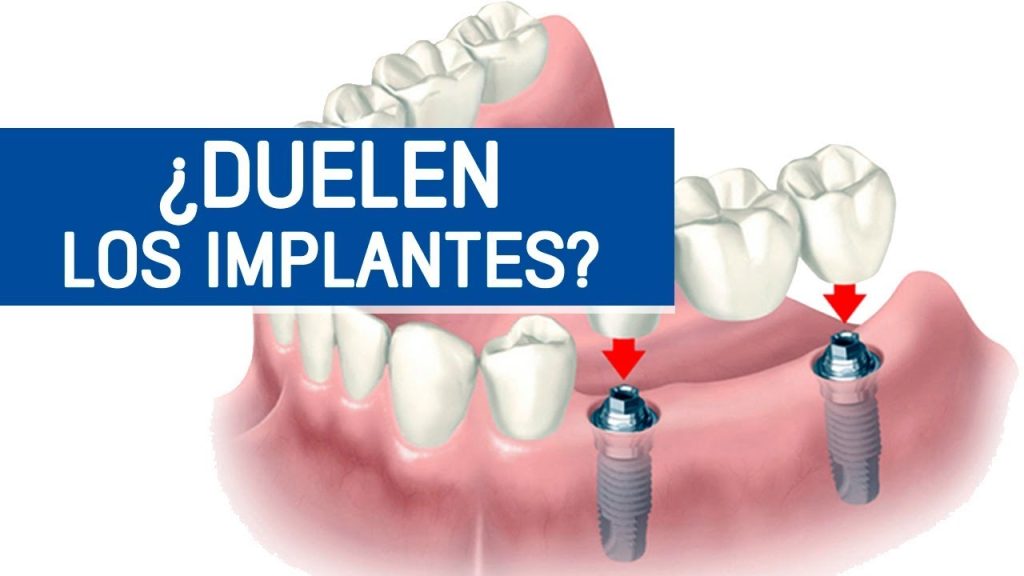 dolor implantes