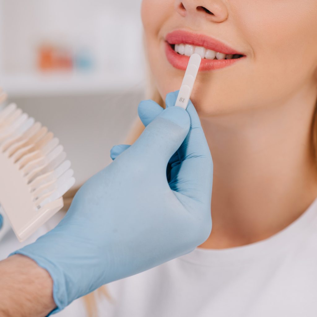Blanqueamiento dental