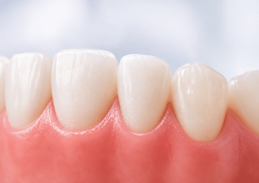 tratamiento odontología conservadora